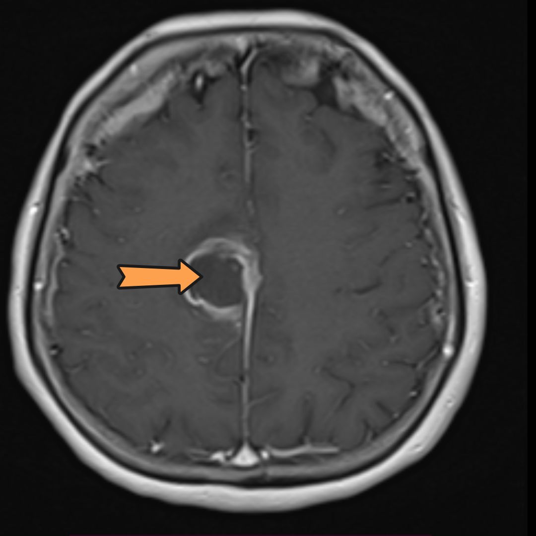 David Tafur Muñoz-2327