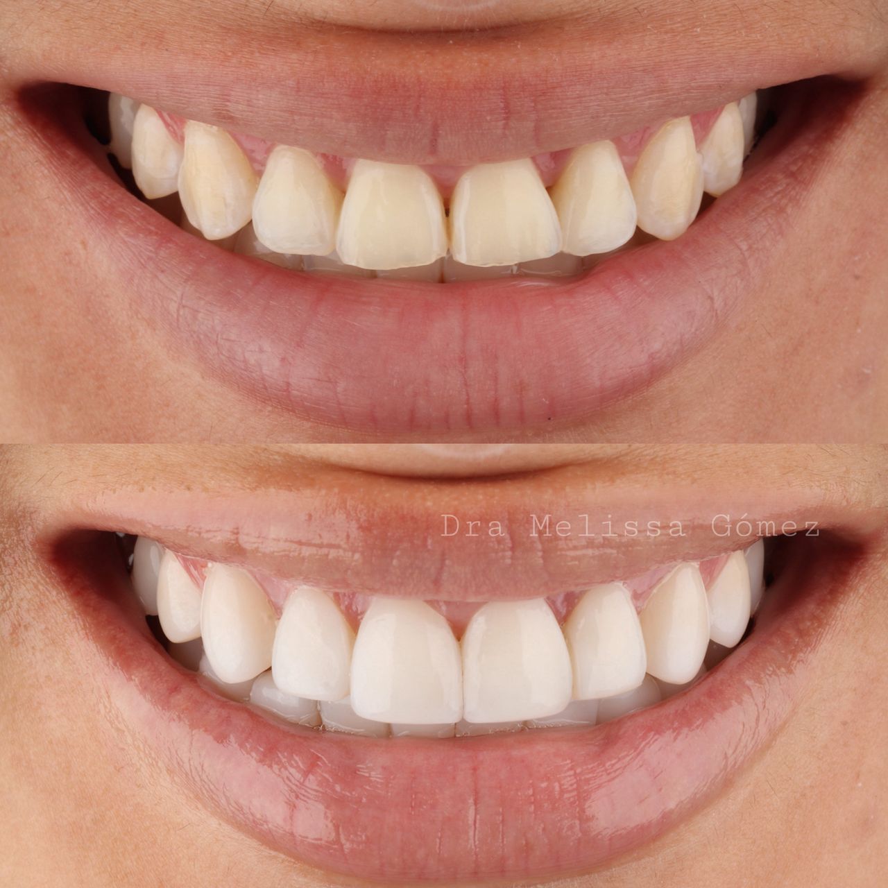 Melissa Gómez Arango-11