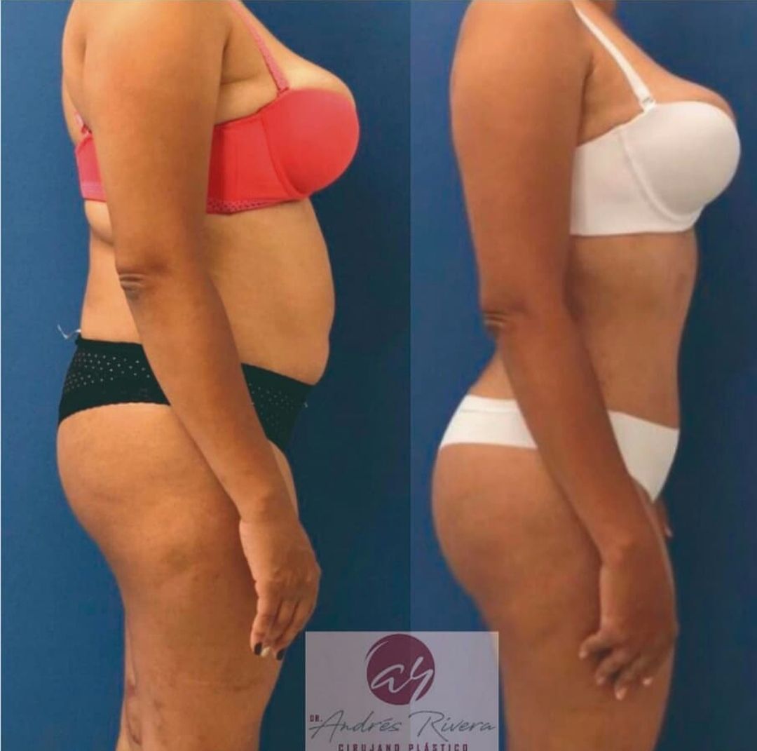 Andrés Rivera López-55