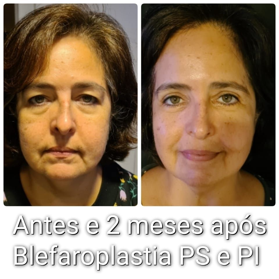 Ingrid  Lustosa Madeira Neves-17