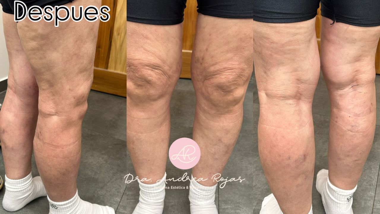 Andrea Rojas Rivera-8