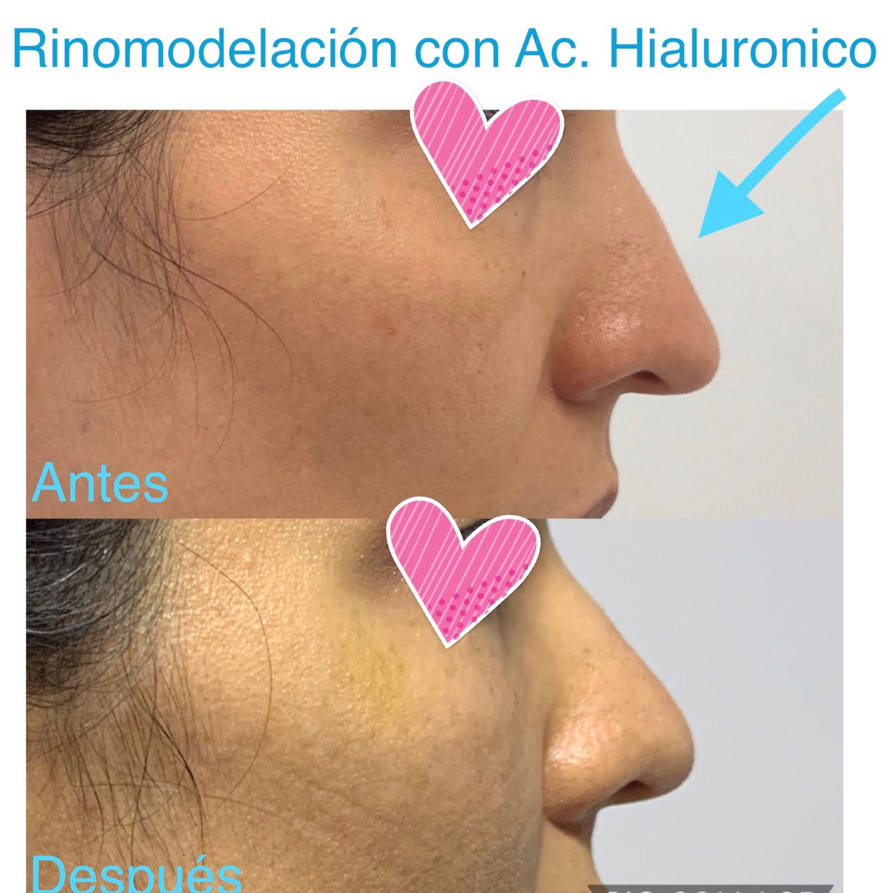 Maria Gisela Angel Losada-8