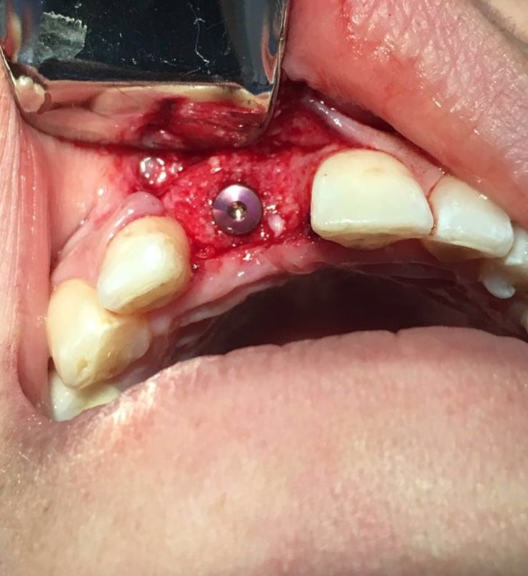 Veronica Maria Barquero Figueroa-10