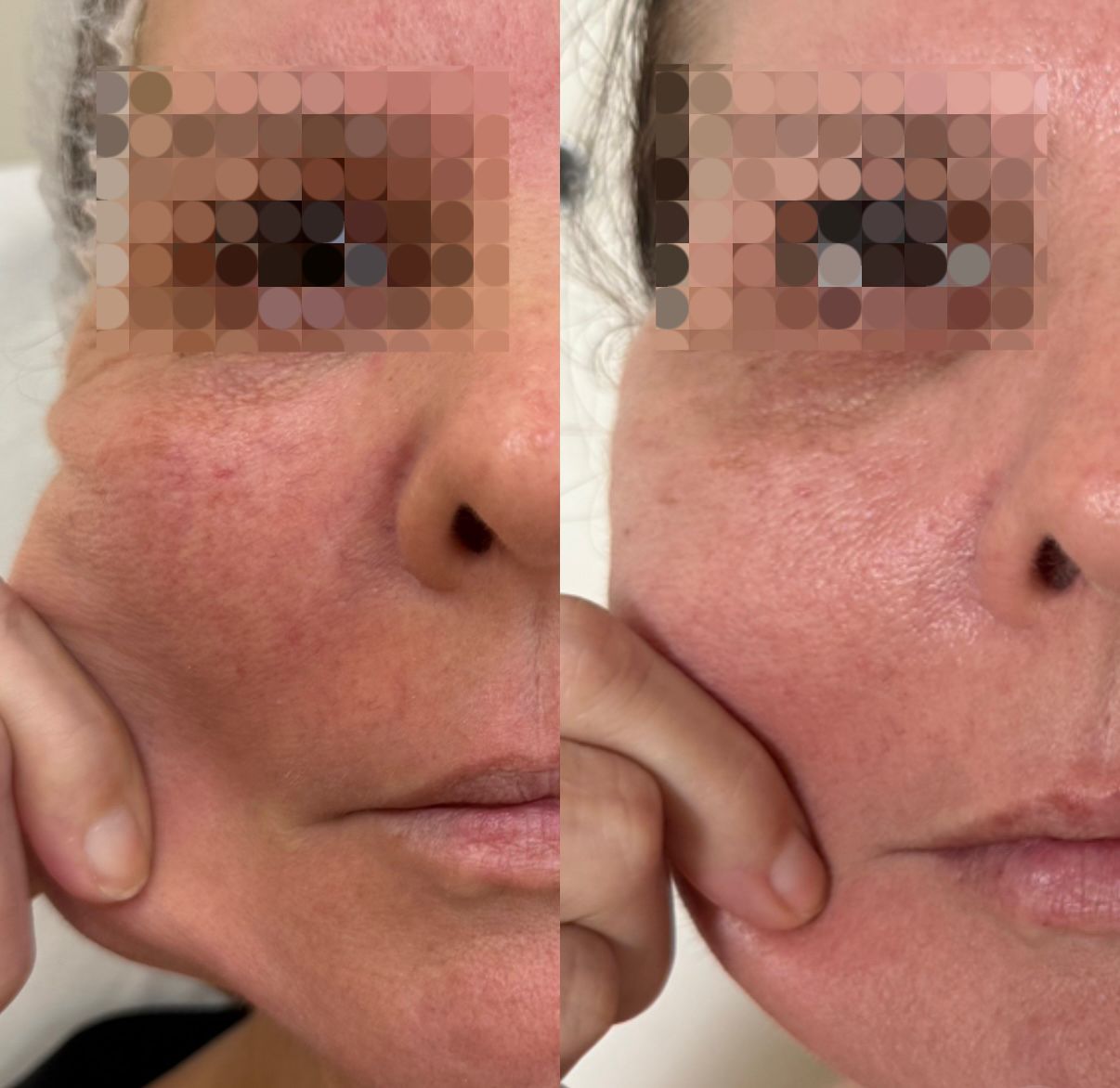 Alana  Meira Silveira Potiguara -2