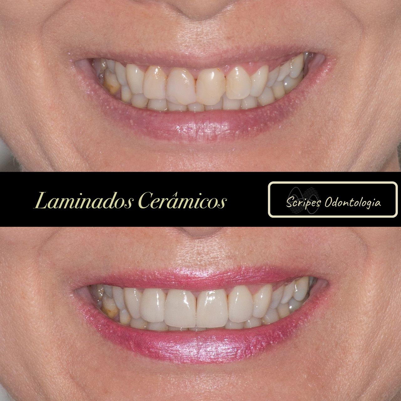 Gabriel Godoy Scripes-31