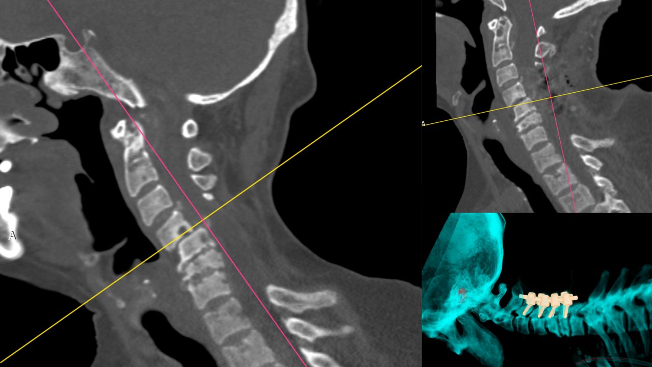David Tafur Muñoz-1195