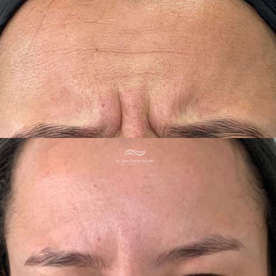 Juan Camilo Castillo-22