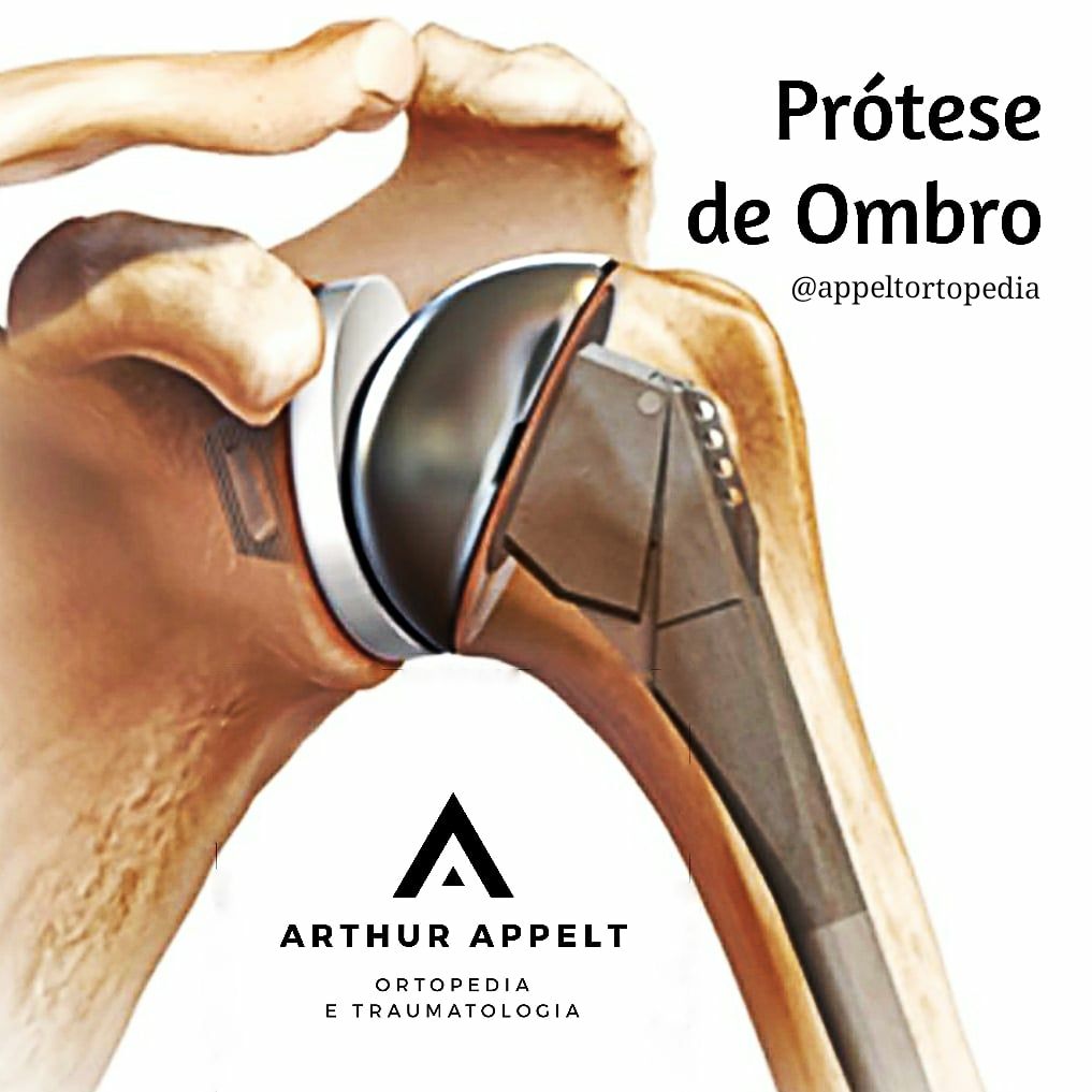 Arthur Lanna Appelt-13