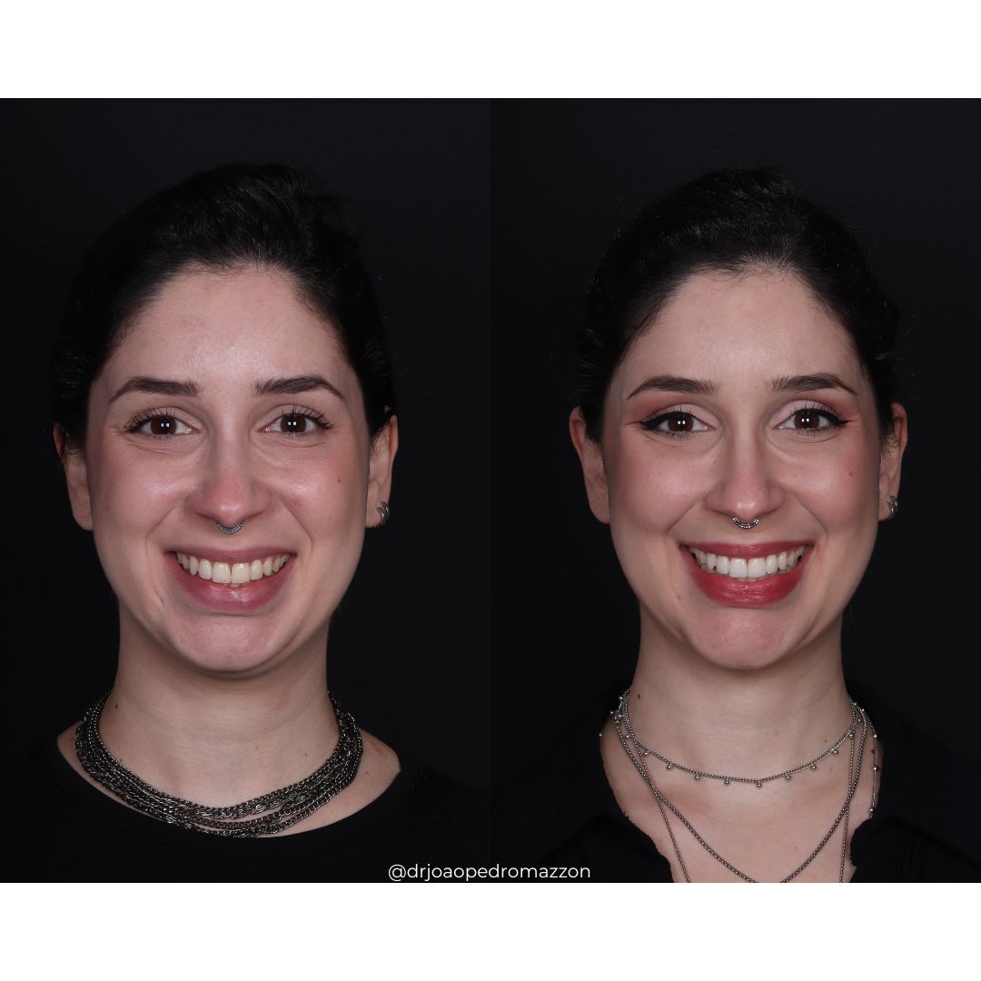 João Pedro Paulino Mazzon-23