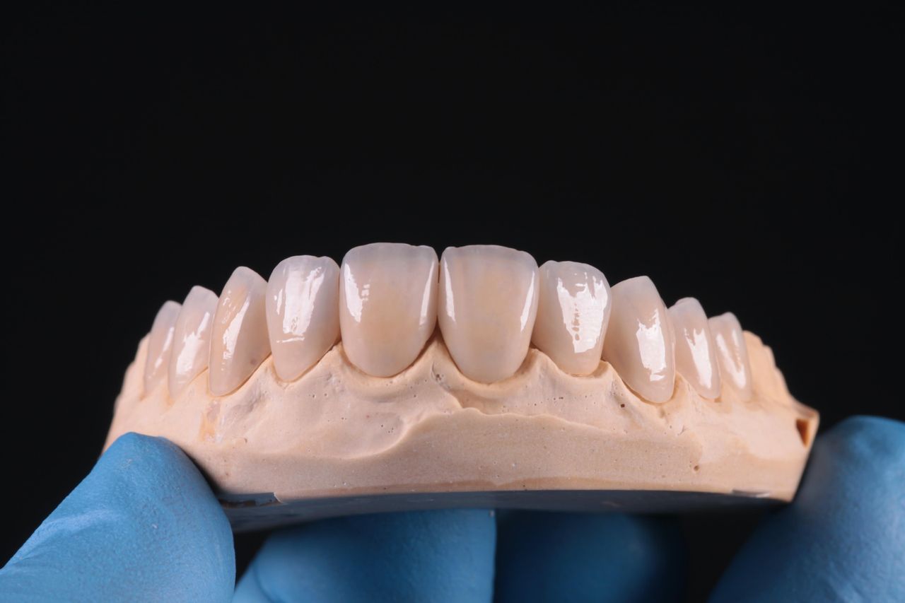 Guilherme  Carvalho-9