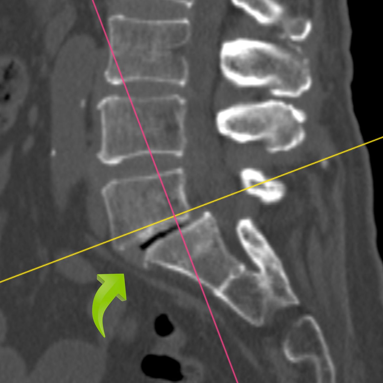 David Tafur Muñoz-1700