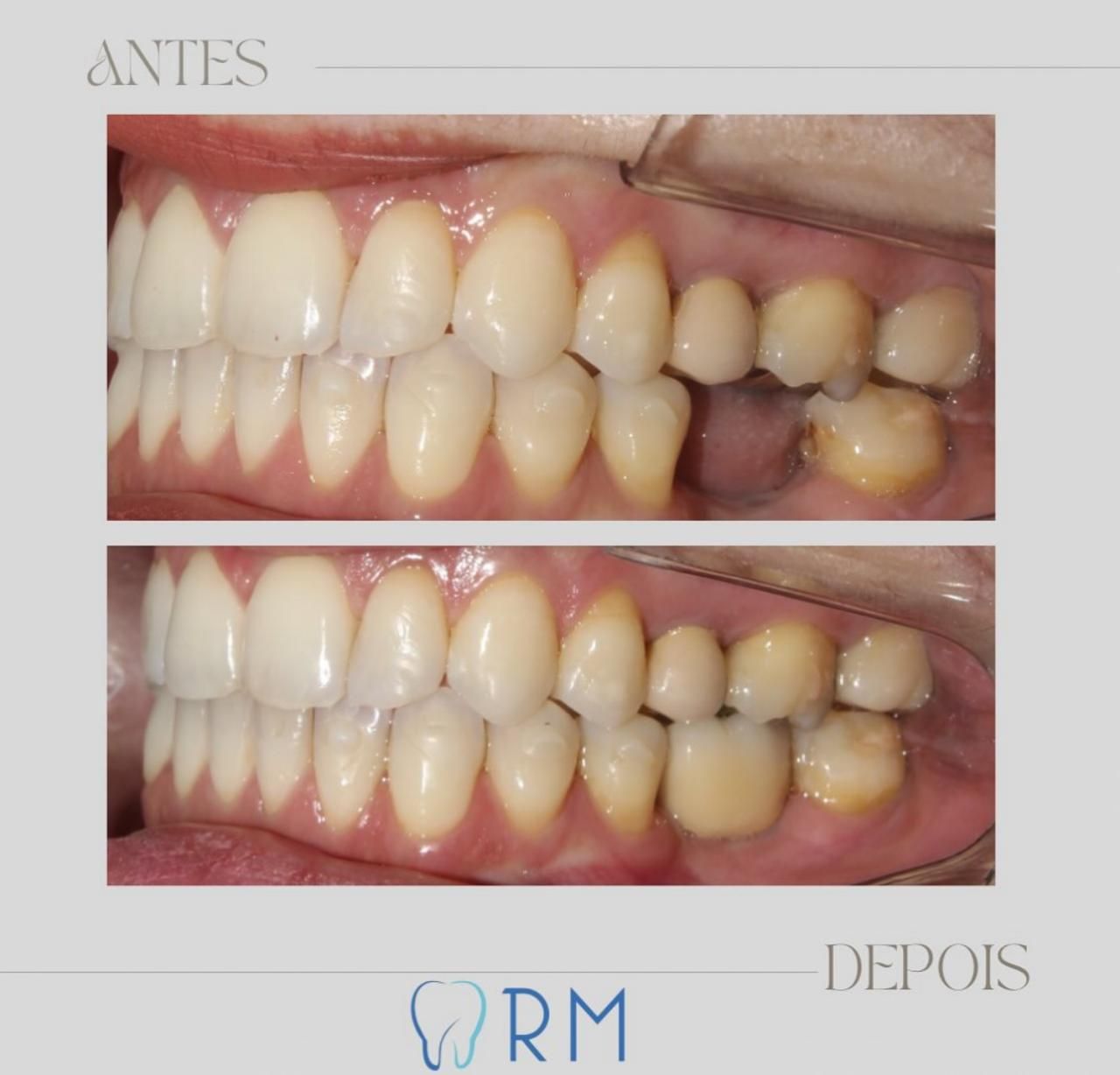Rafaela Maria Silva Moreira-14