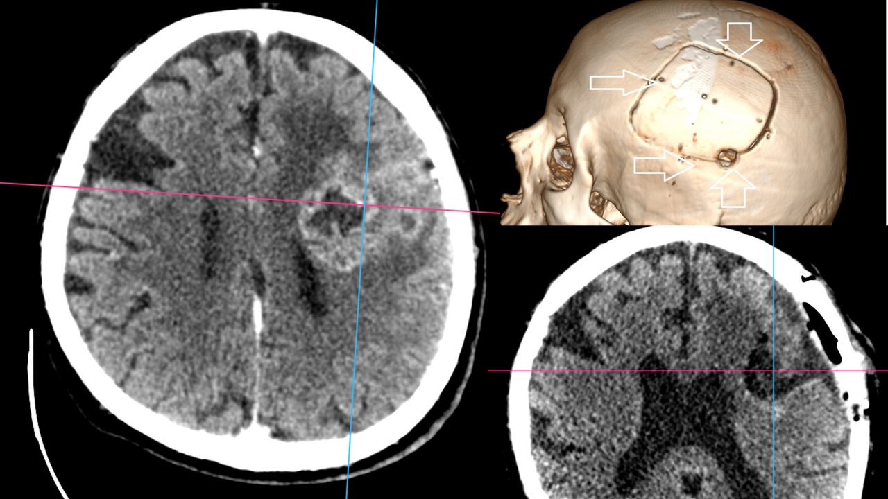 David Tafur Muñoz-2215