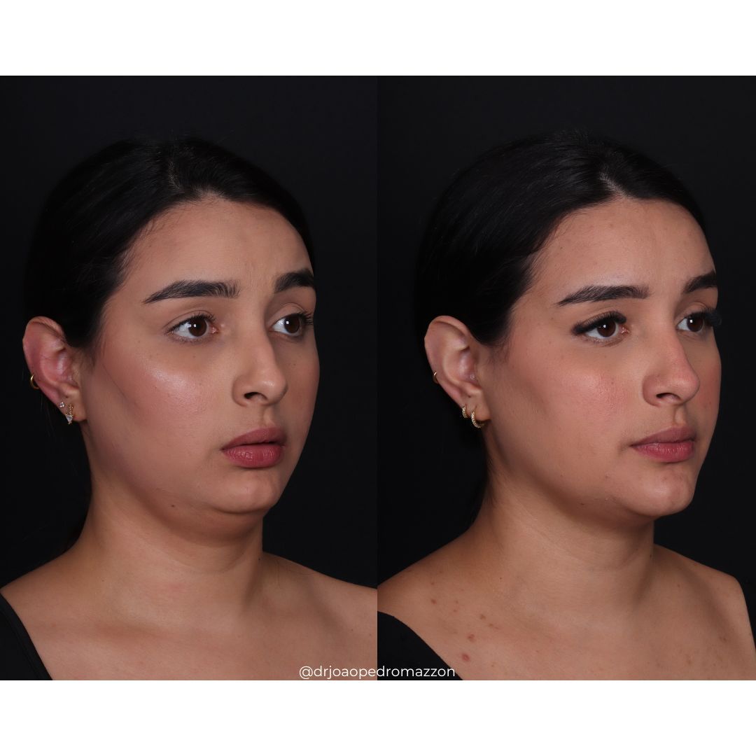 João Pedro Paulino Mazzon-2