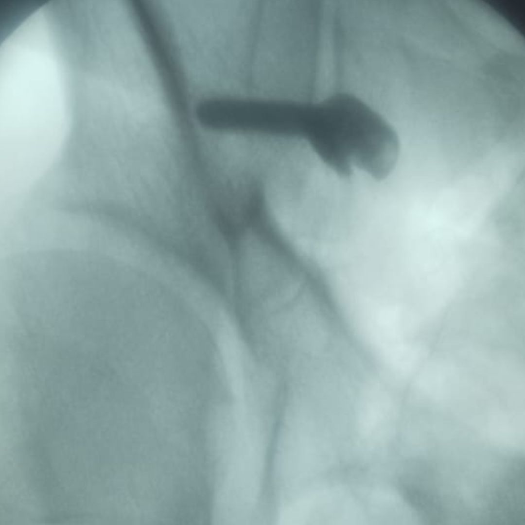 David Tafur Muñoz-2332