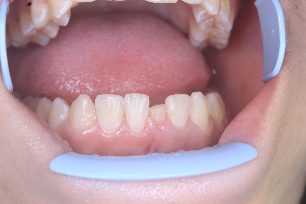 Francisco Bahamonde-9