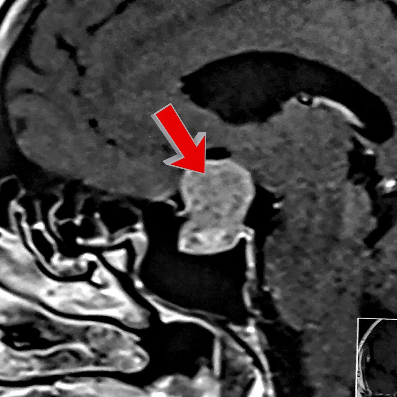 David Tafur Muñoz-1087