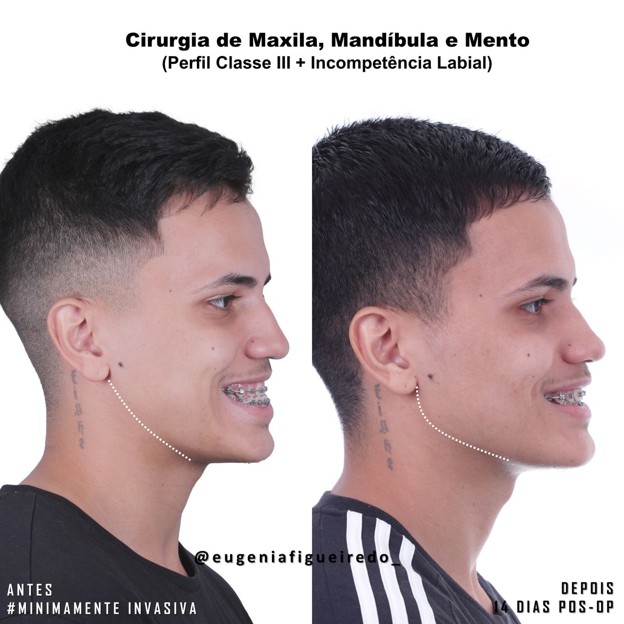 Eugênia Figueiredo-10