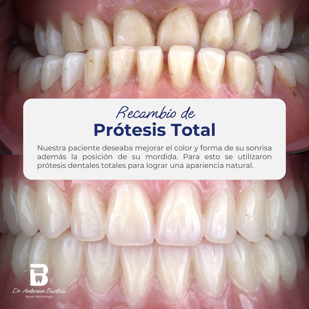 Andersson Buritica-8