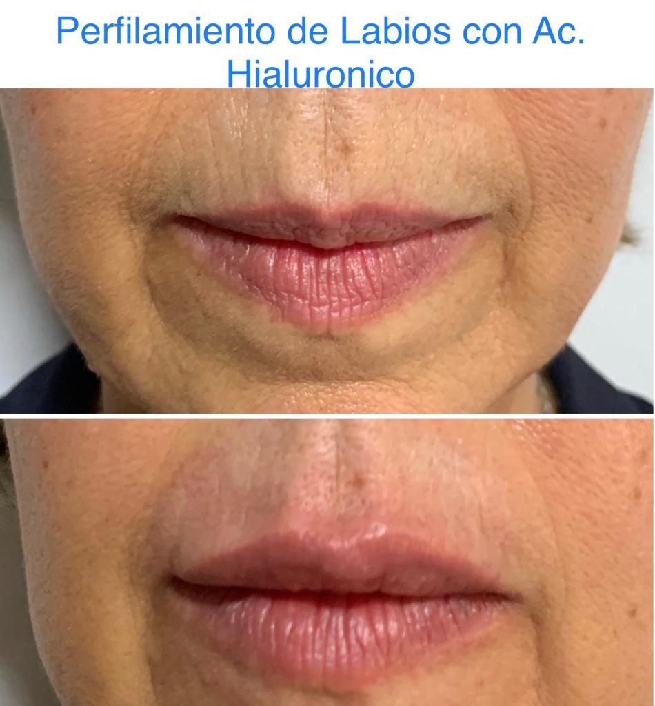 Maria Gisela Angel Losada-49