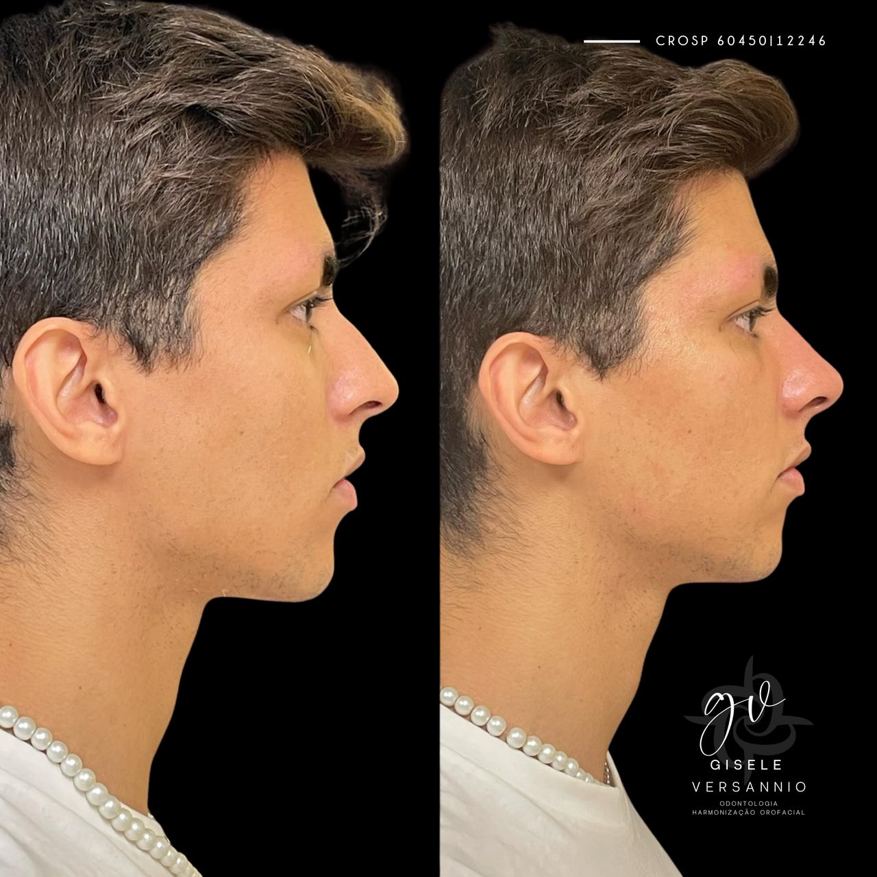 Gisele De Carvalho Versannio-34