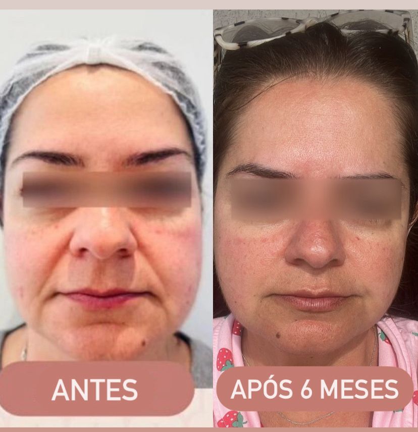 Ana Carla Rocha De Araujo-4