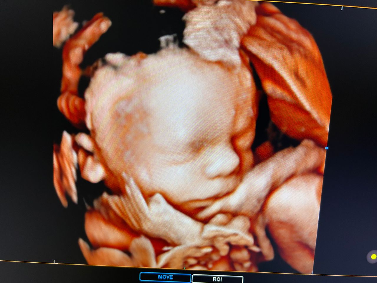 Leandro Nogueira Freitas-0