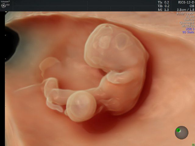 Raul Javier Banderas Pumarino-12