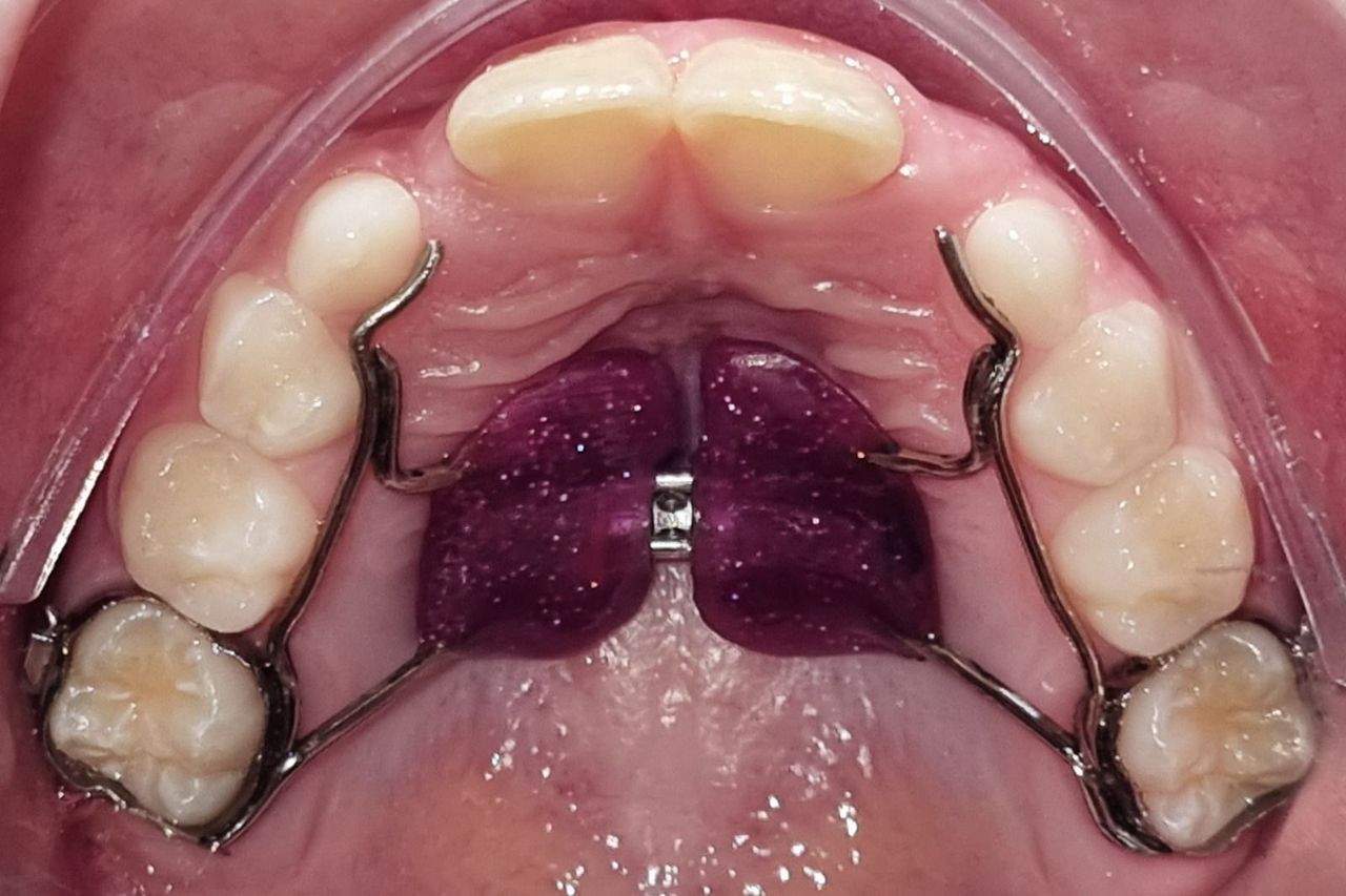 Giovanna Purkote Yamaguchi-0