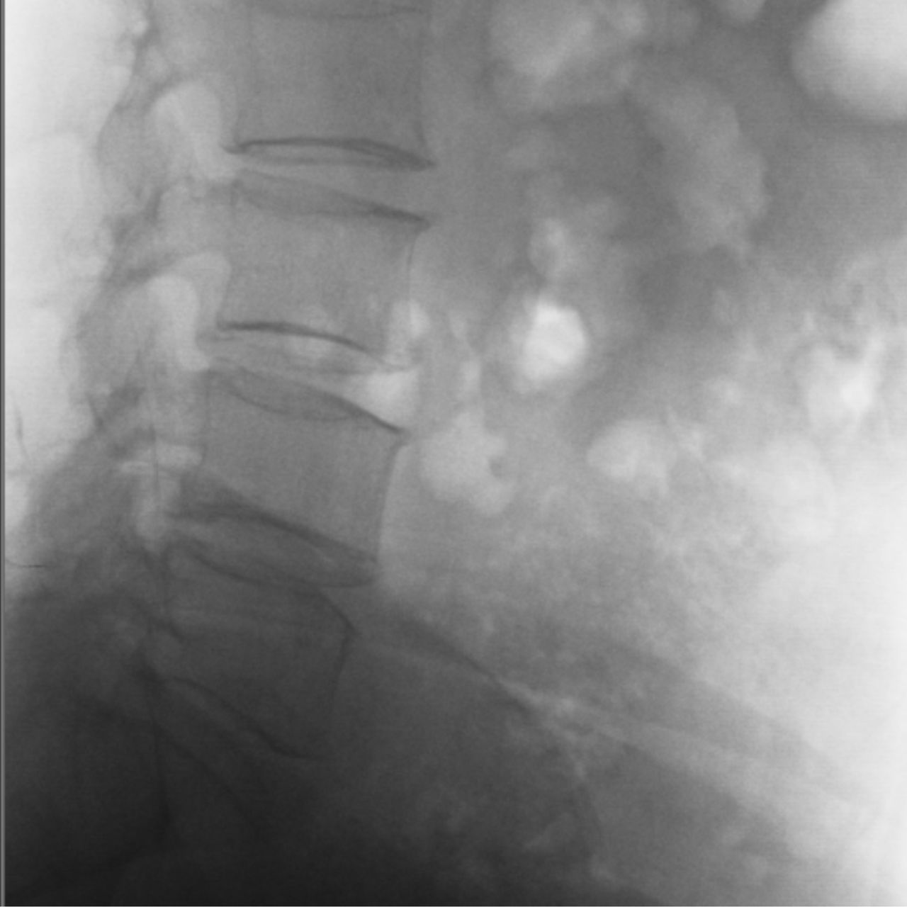 David Tafur Muñoz-1704