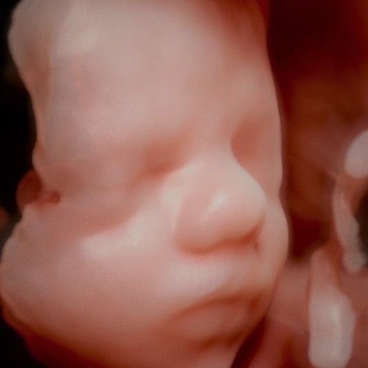 Charles Schwantz De Lima-20