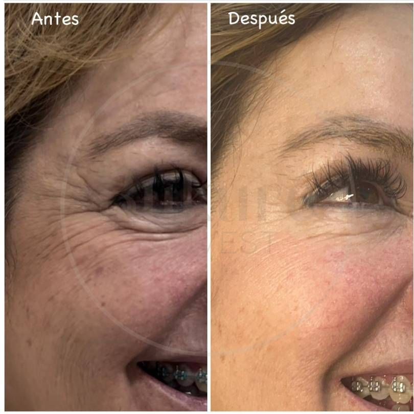 Oscar Iván Lozano Navarrete-11