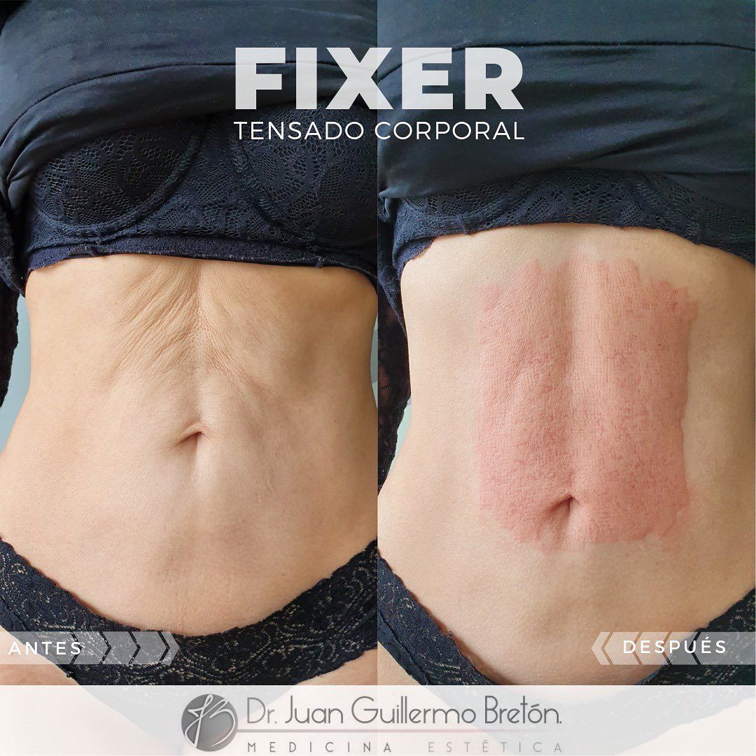 Juan Guillermo Bretón Franco-8