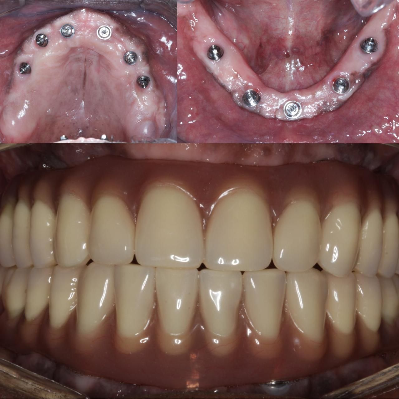 Antônio Alegria Do Nascimento-5