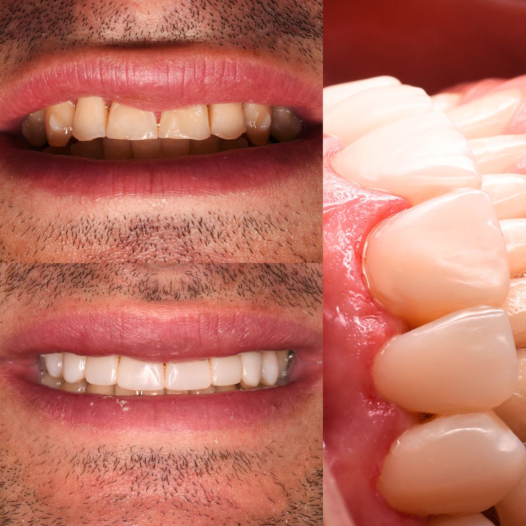 Andrés Verdugo Bolumburu-1