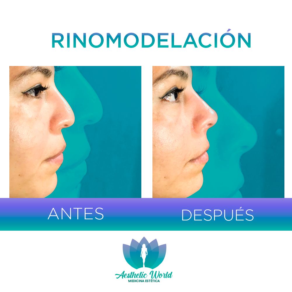 Jhonatan Oyola Farfán-4