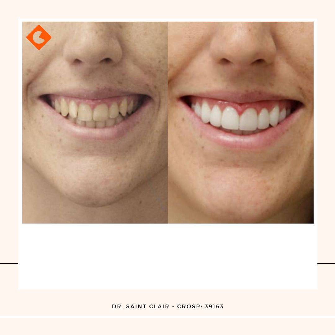 Saint Clair Barbosa Netto-20