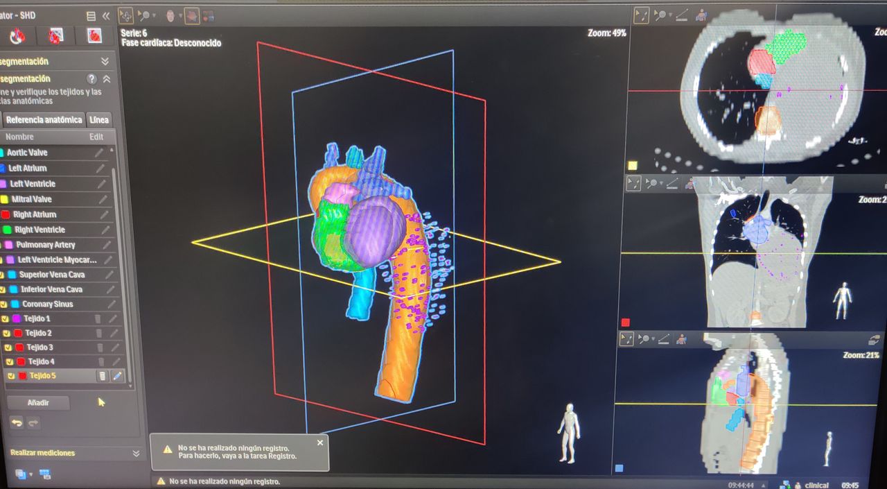 Willfredy Castaño Ruiz-19
