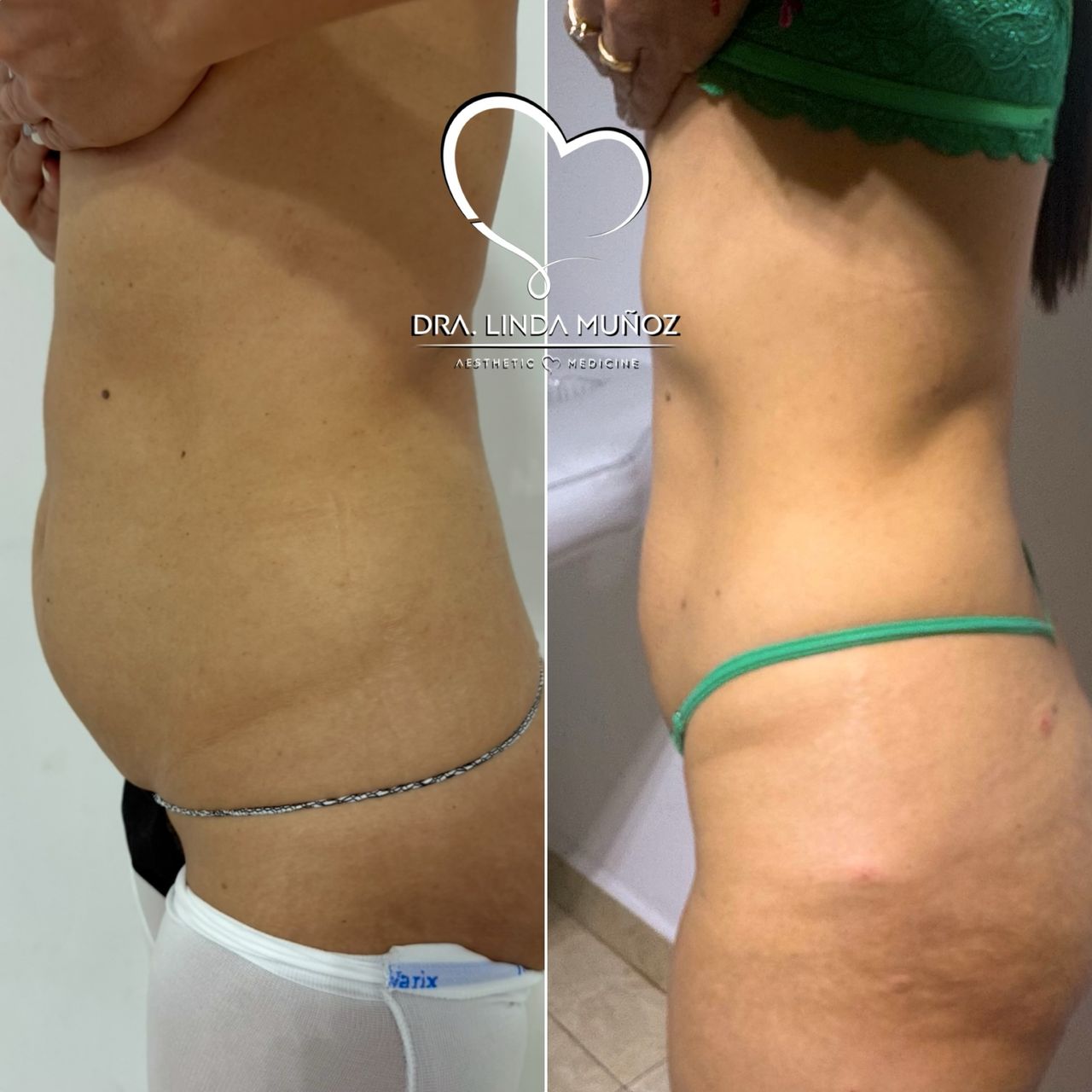 Linda Muñoz-15