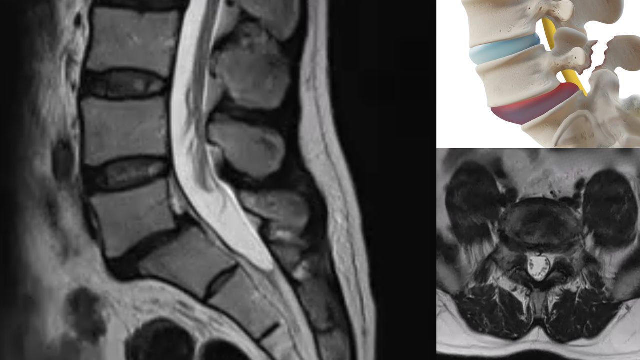 David Tafur Muñoz-1199