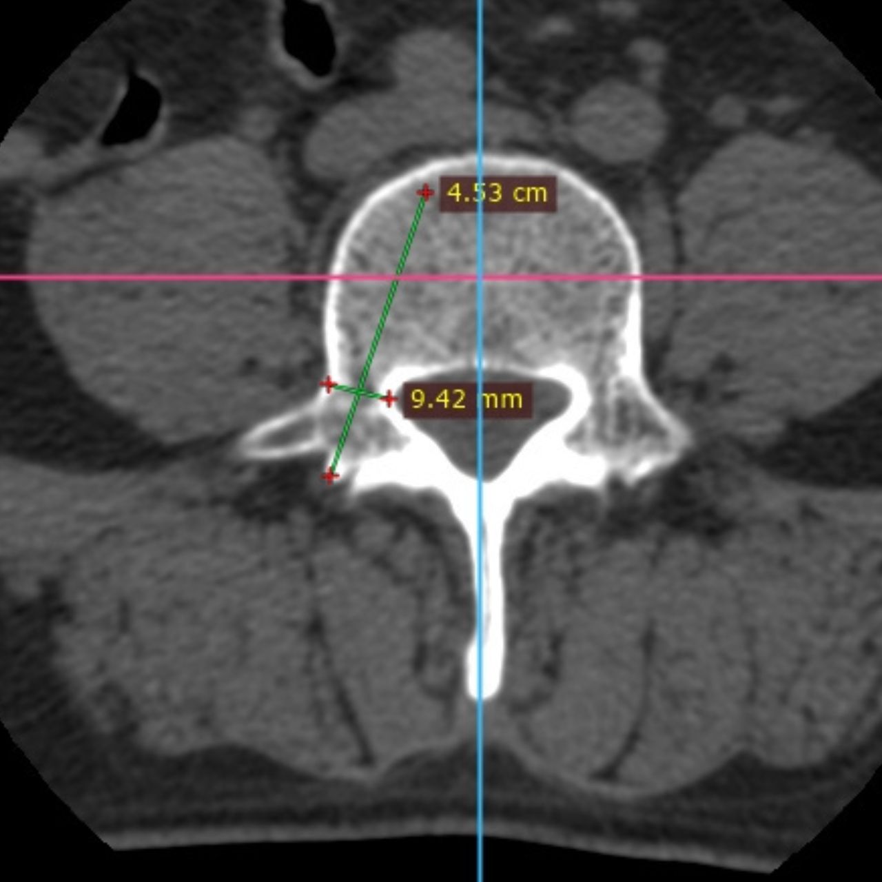 David Tafur Muñoz-1467