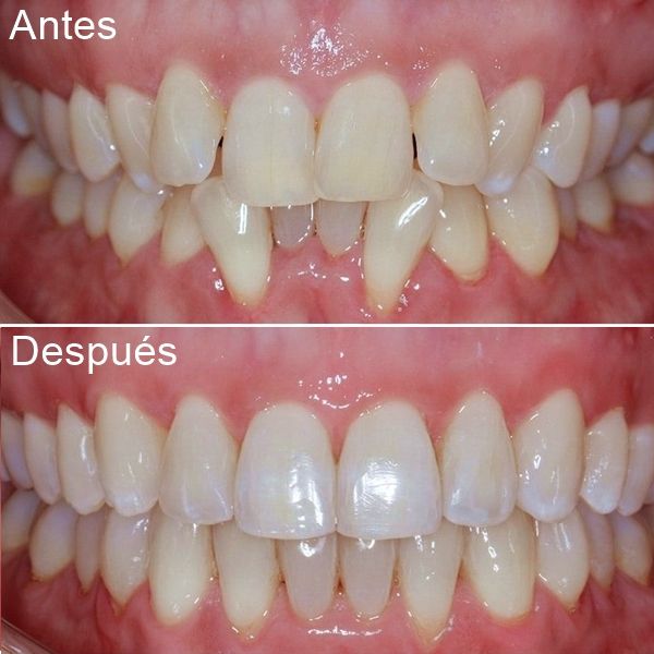 Frank Mendoza Alanya-32