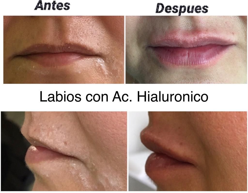 Maria Gisela Angel Losada-46