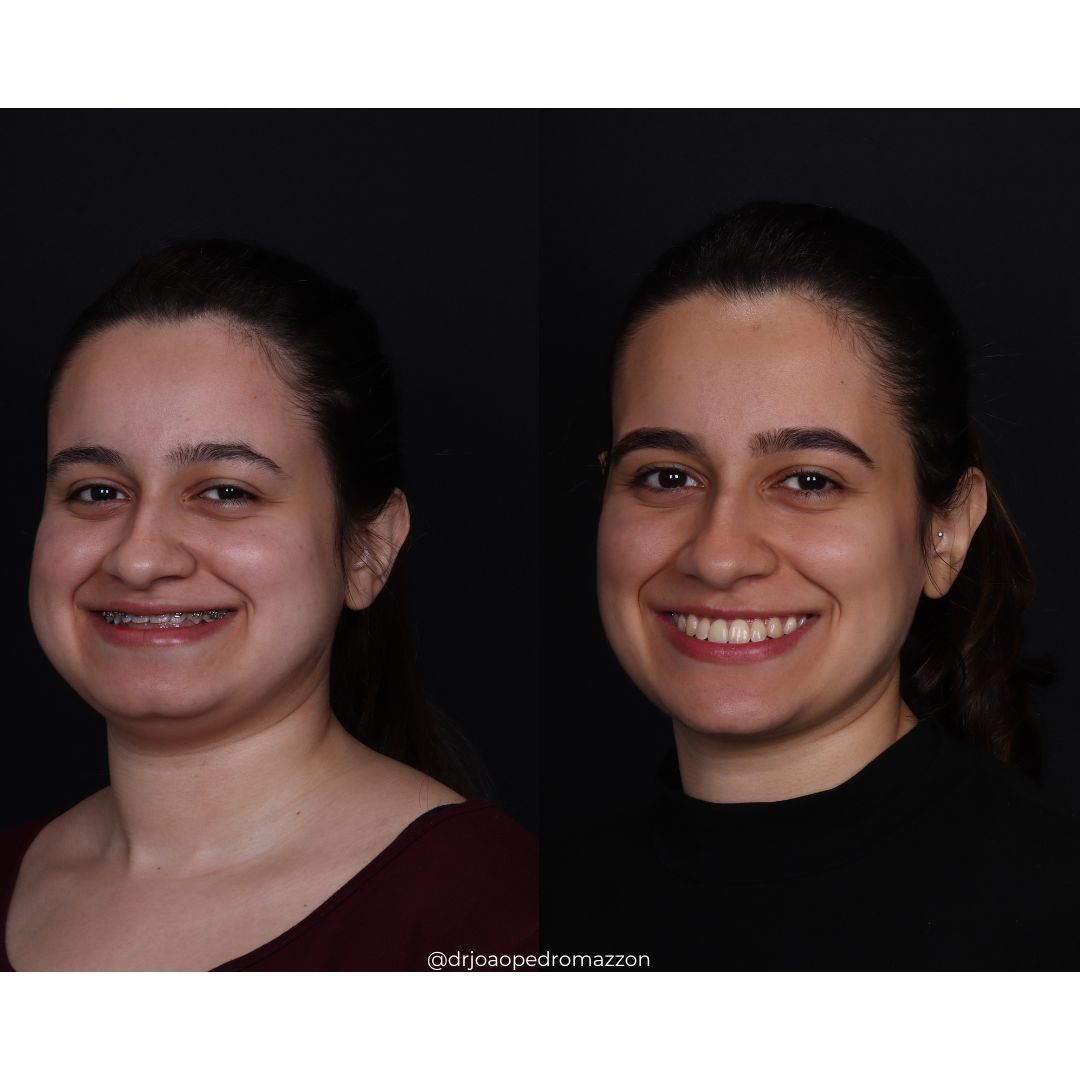 João Pedro Paulino Mazzon-68