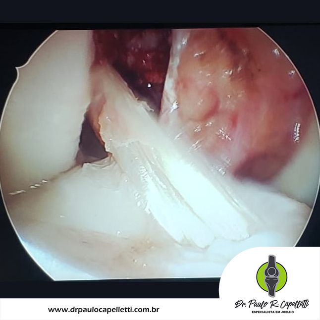 Paulo Roberto Capelletti-58