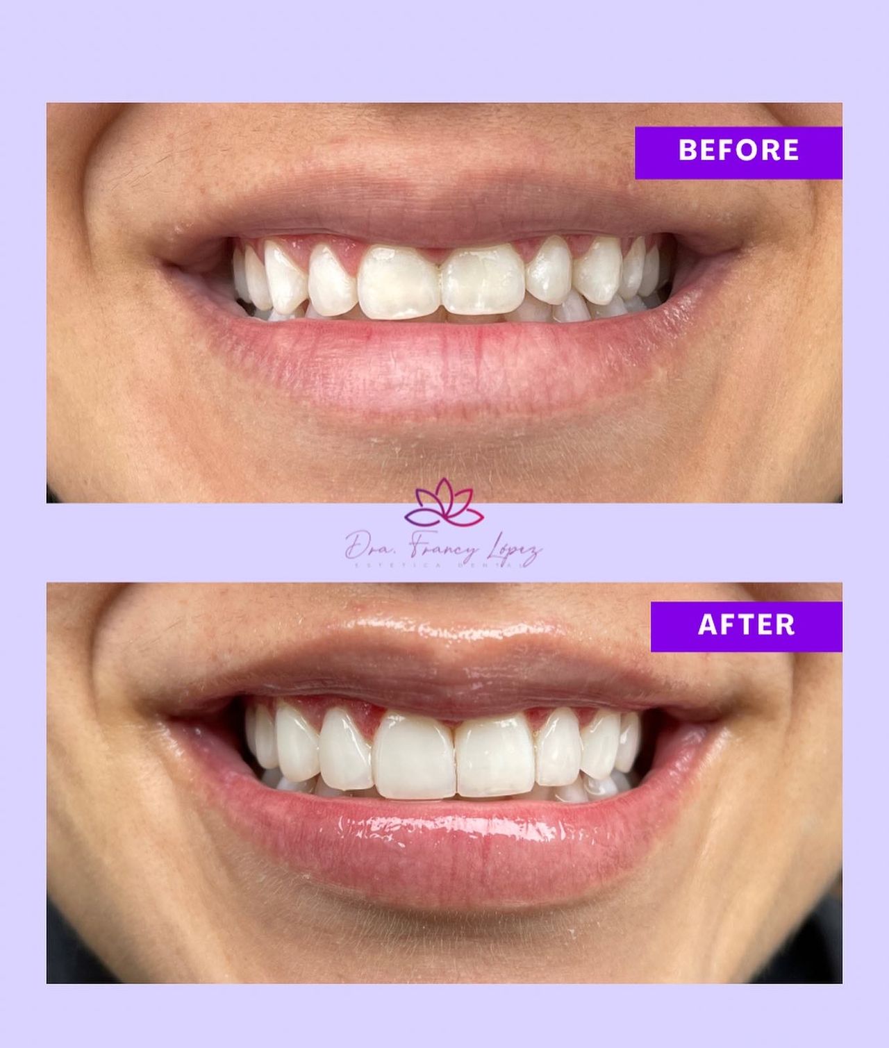 Franci Yulied López Jiménez-14