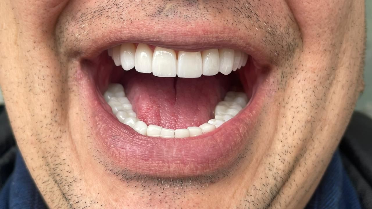 Franci Yulied López Jiménez-19