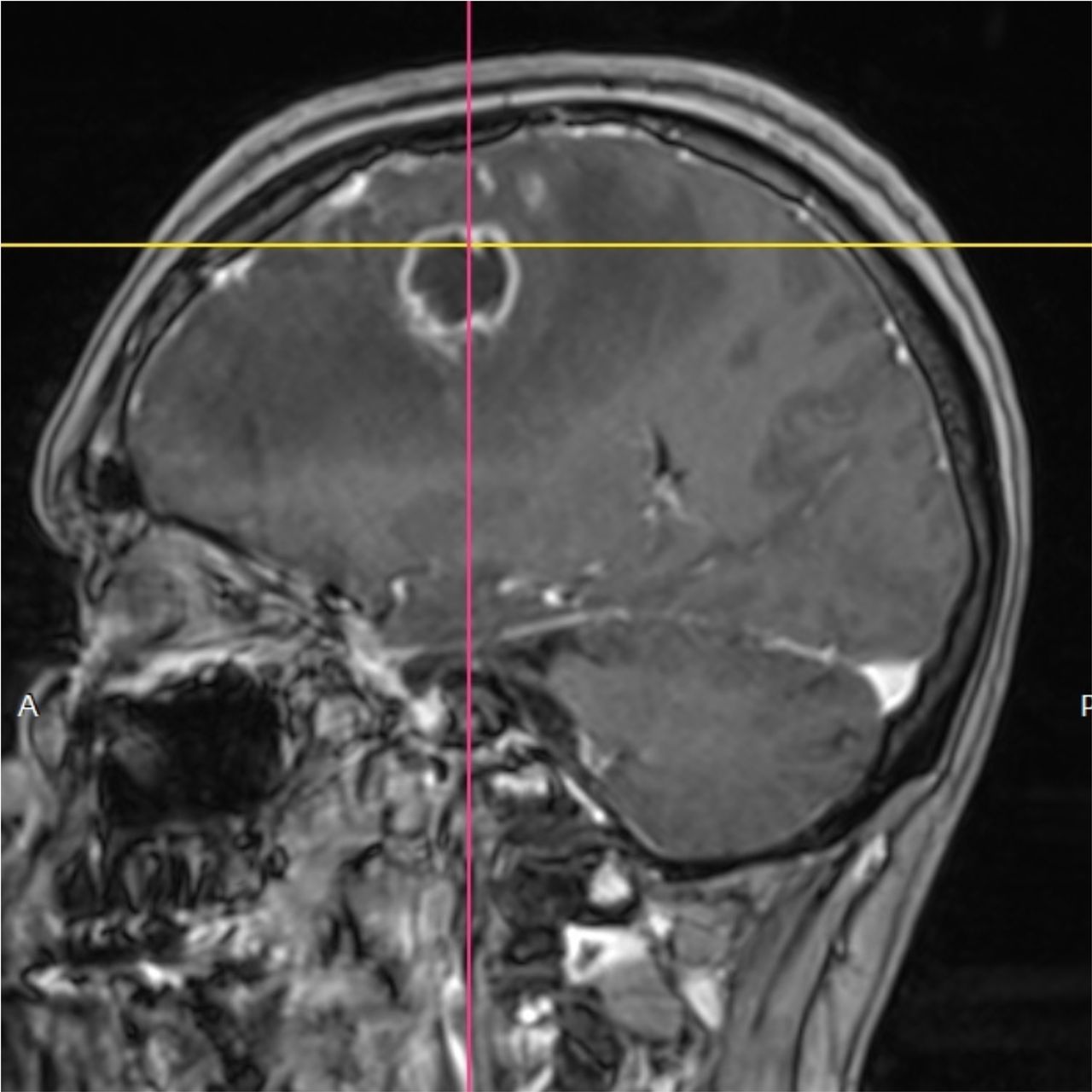 David Tafur Muñoz-1450