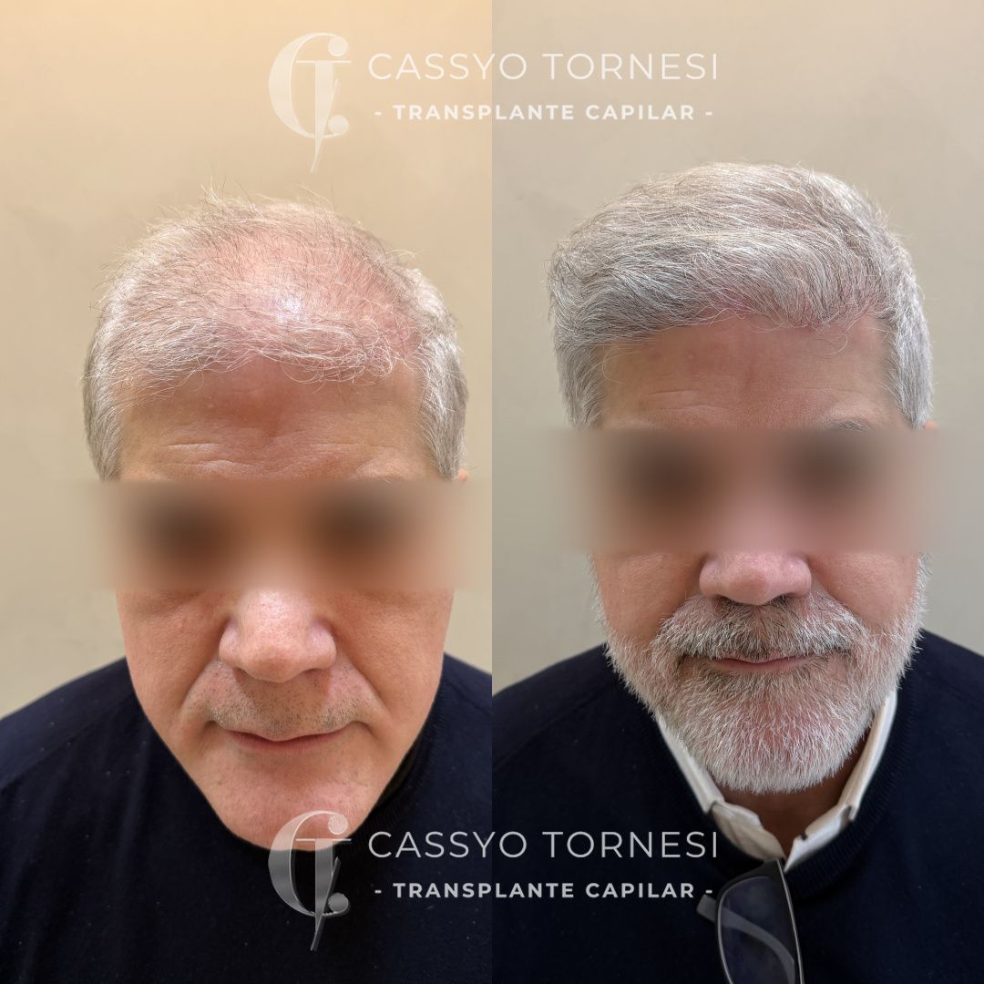 Cassyo Tornesi-31