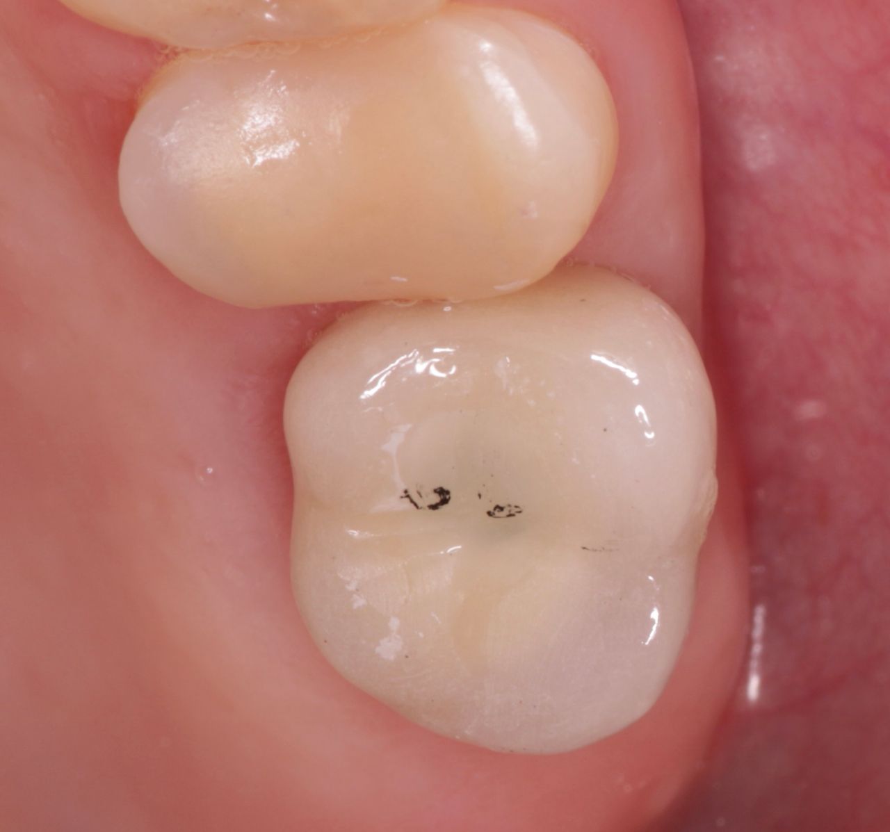 Luis Muñoz Tolhuysen-13